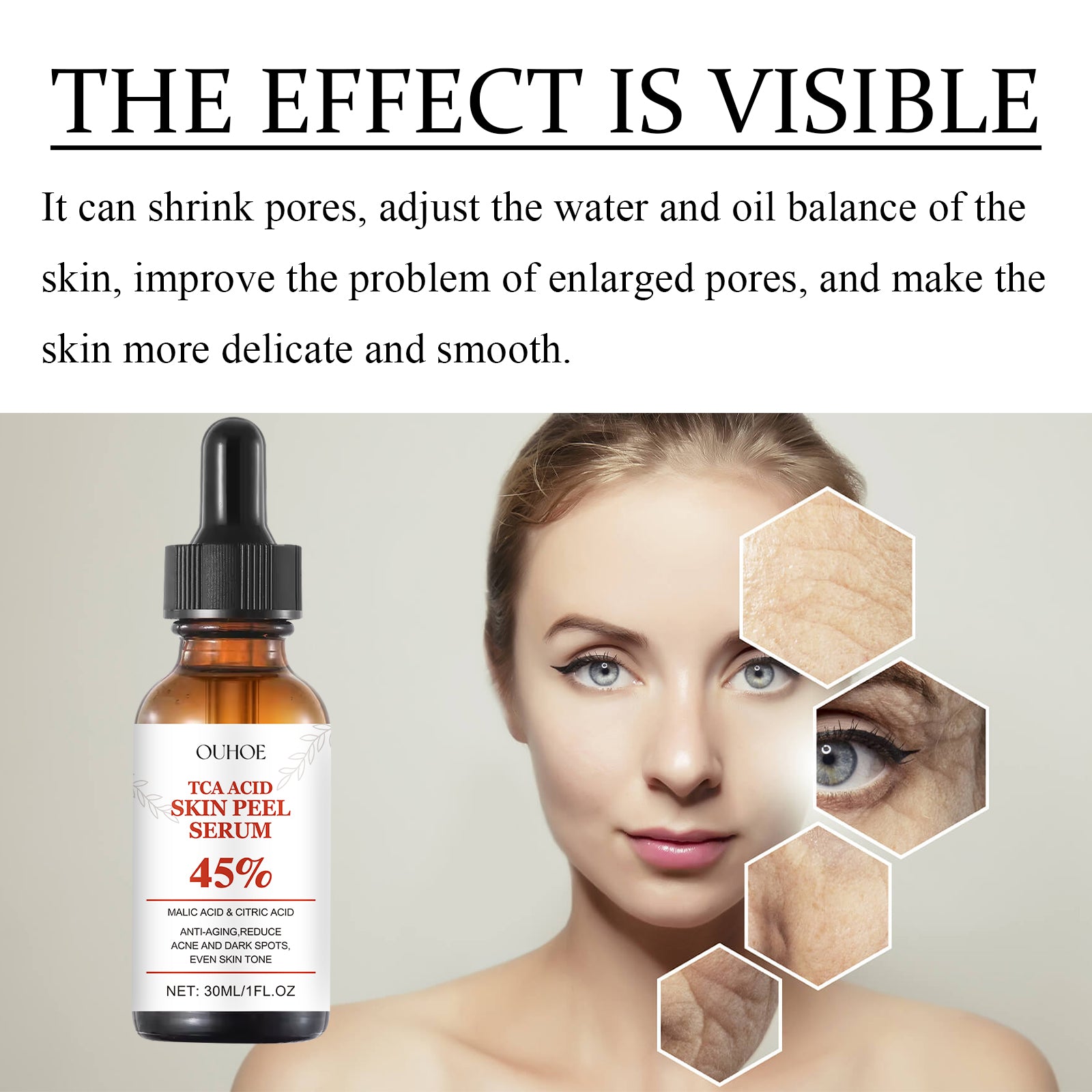 OUHOE TCA Acid Skin Peel Serum